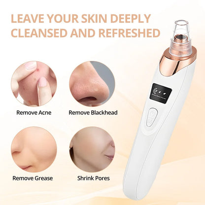 Portable Electric Blackhead Remover – Home Skincare Device