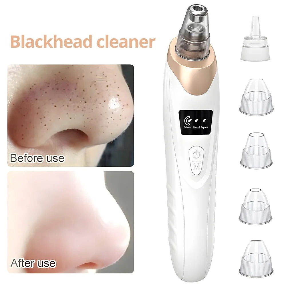 Portable Electric Blackhead Remover – Home Skincare Device